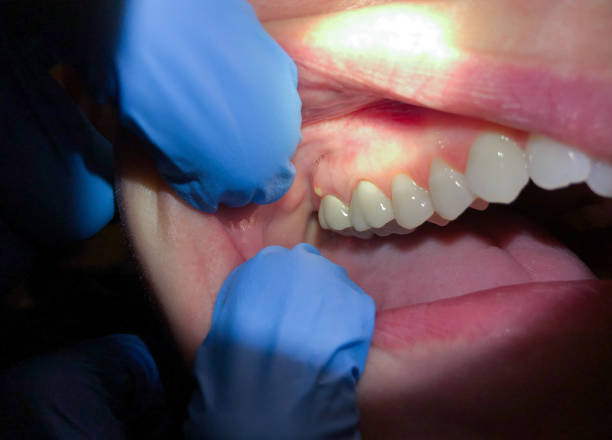 Best Pediatric Emergency Dentist in Freemansburg, PA